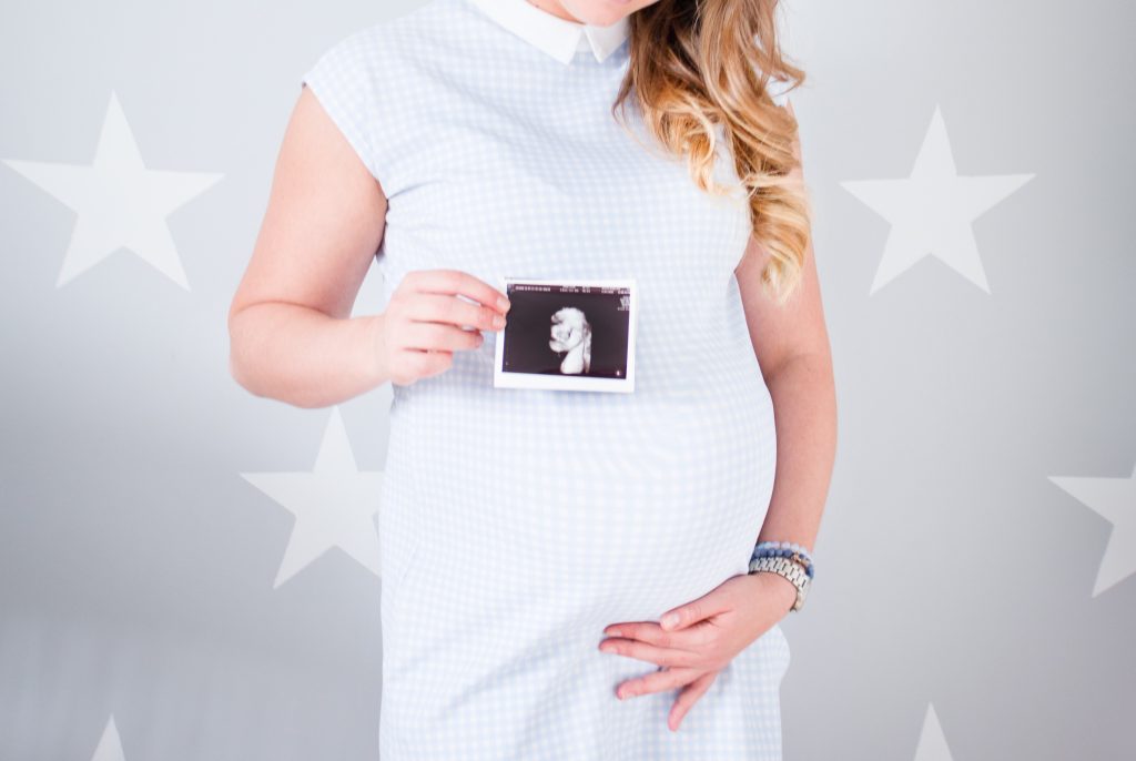 Pregnant woman holding picture of ultrsound