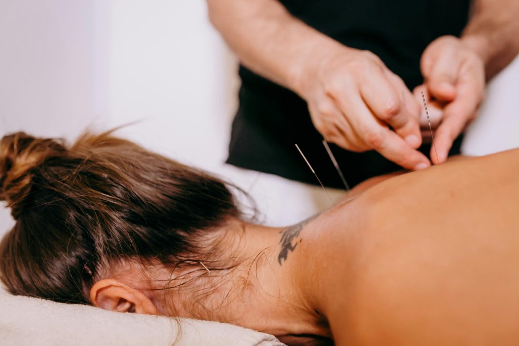 Woman receiving acupuncture in the neck by alma thai